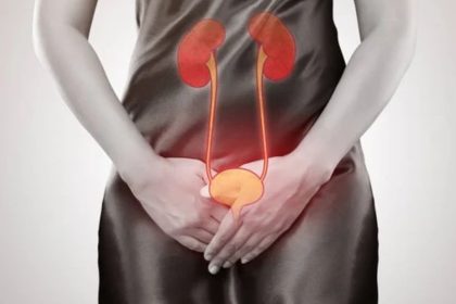 Ilustração dos rins destacando infecção urinária avançada e pielonefrite